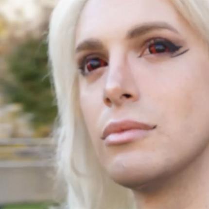 ο ανθρωπος με τις 32 πλαστικες