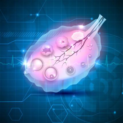 ovary.jpg