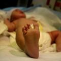 Πέθανε μωρό 18 μηνών από ιλαρά στην Γερμανία