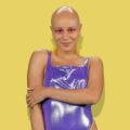 gntm-katsanikaki-alopekia.jpg