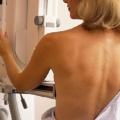 Επιμένει στην πρόληψη του καρκίνου η Ελληνική Εταιρία Μαστολογίας