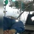  γιατροί έσωσαν μωρό που κατάπιε καρύδι 