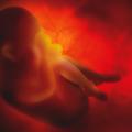 άμβλωση-έμβρυο