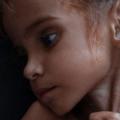 Υεμένη - Λιμός