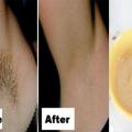 you-only-need-2-ingredients-and-2-minutes-to-get-rid-of-underarm-hair-forever.jpg