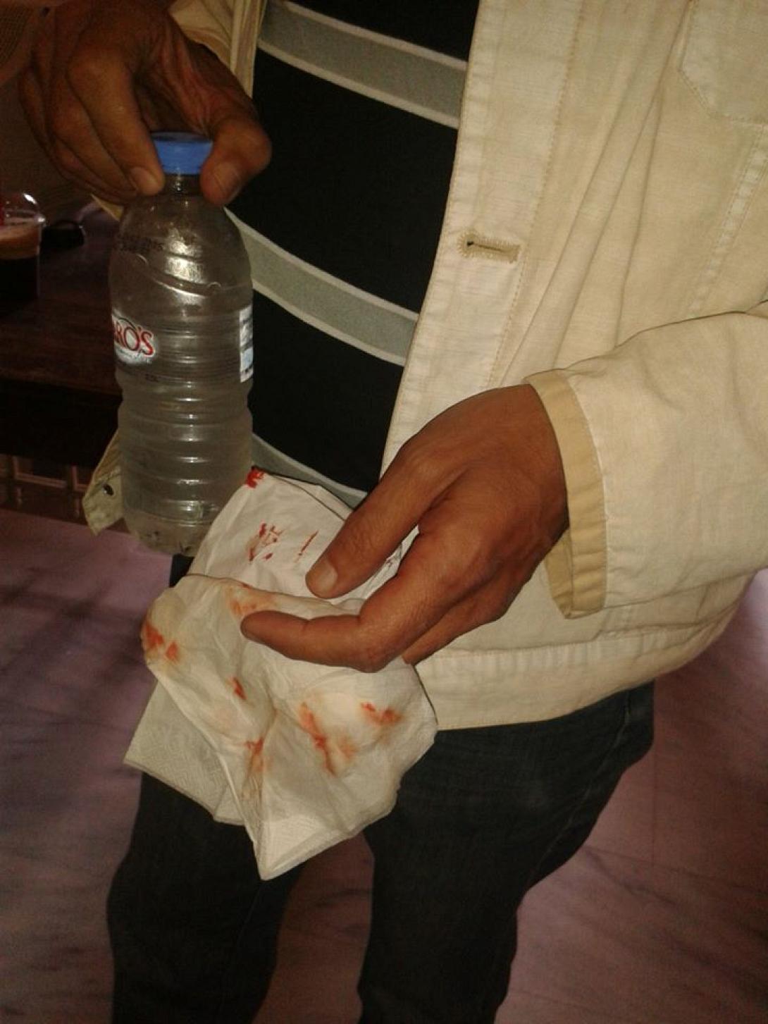 Η Δημοτική Παράταξη &quot;Άμεση Δημοκρατία&quot; καταδικάζει επεισόδια στο Ειρηνοδικείο Ηρακλείου