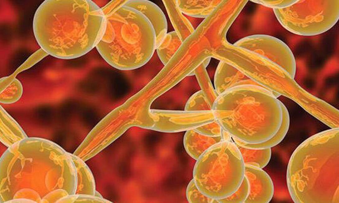 candida auris