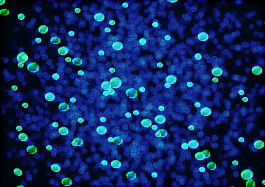 Candida auris...η νέα απειλή για την ανθρωπότητα 