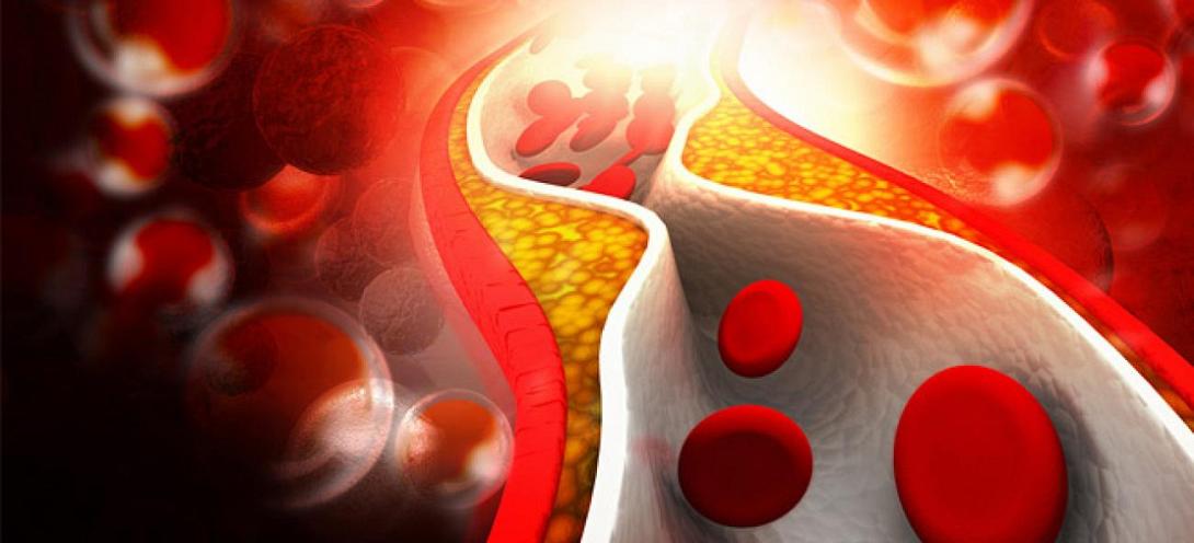 χοληστερίνη