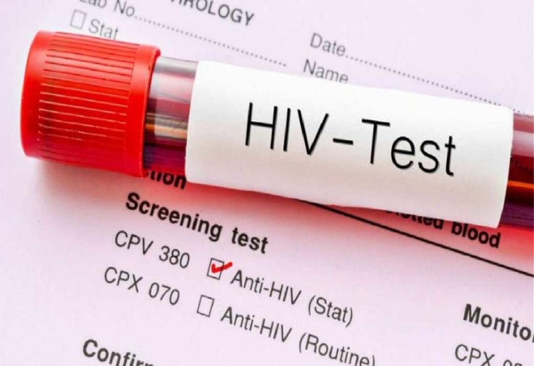 HIV