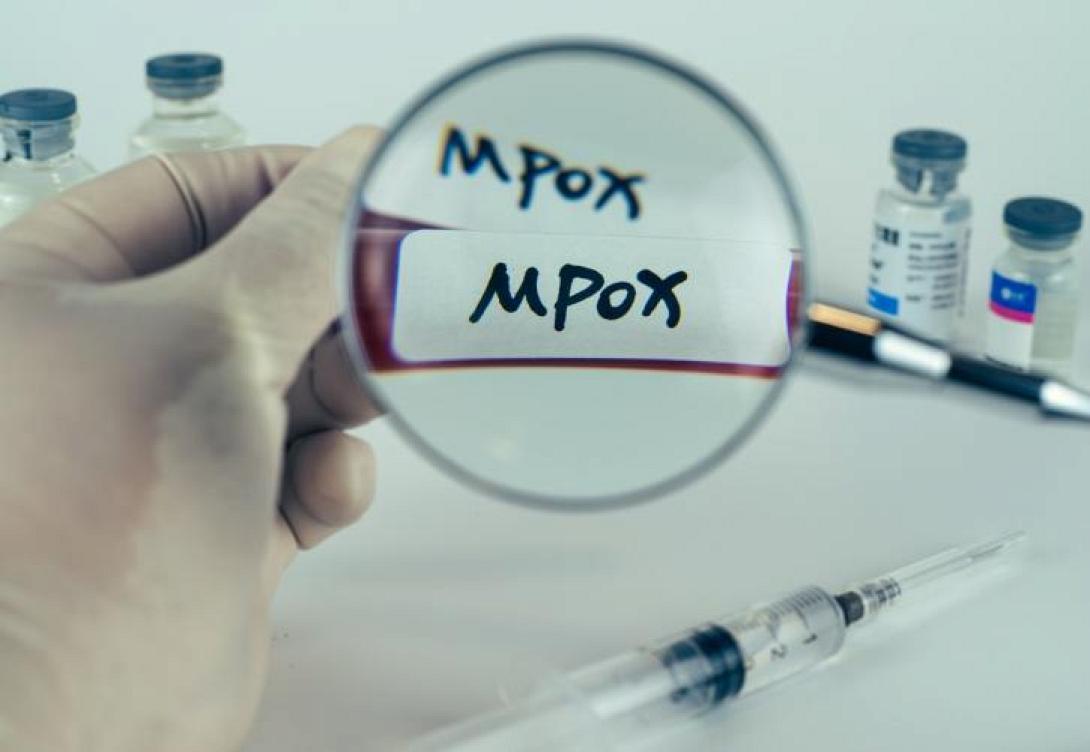 mpox