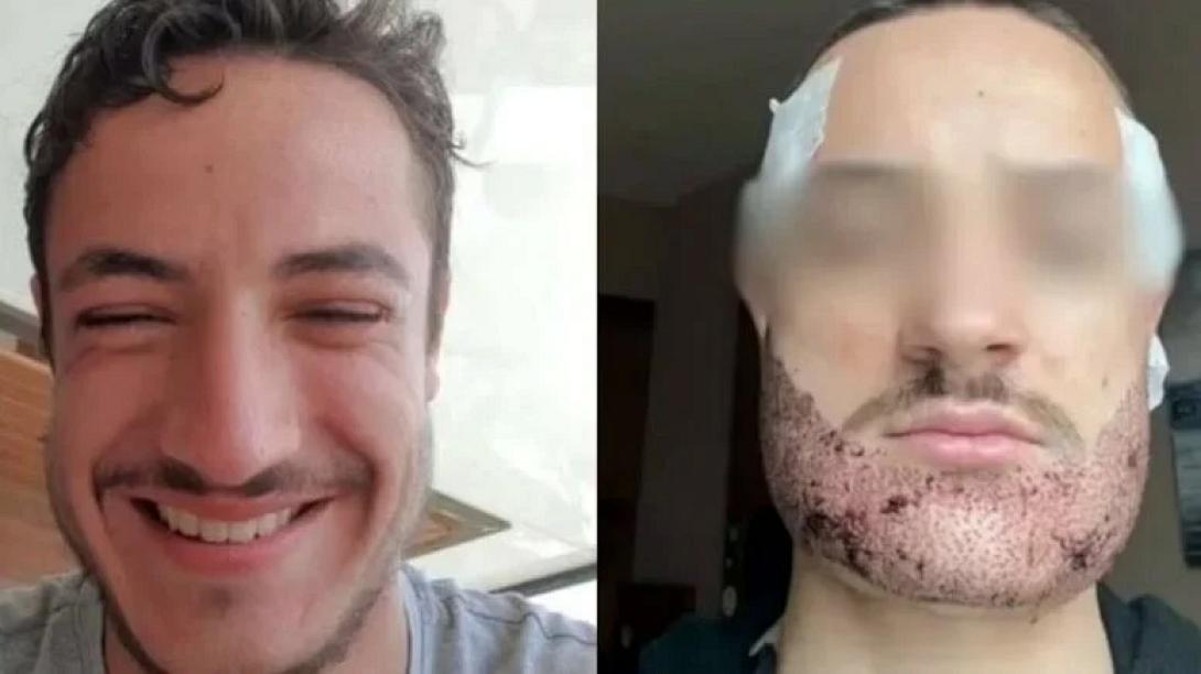γαλλια μουσια