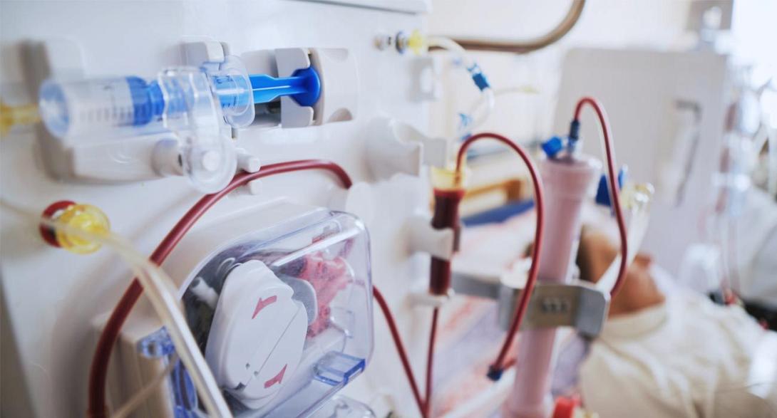 ΑΙΜΟΚΑΘΑΡΣΗ