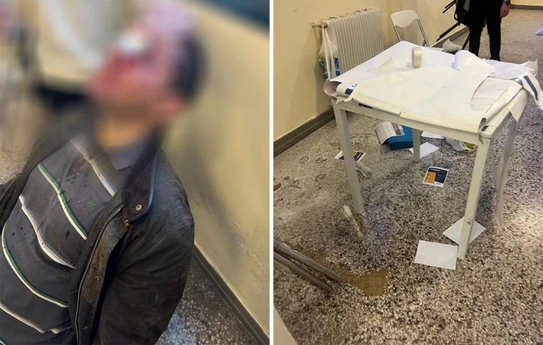 επεισοδια νομικη 