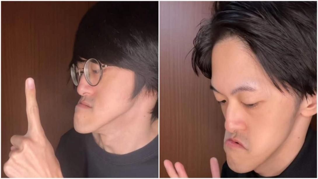 πηγούνι Ιάπωνας