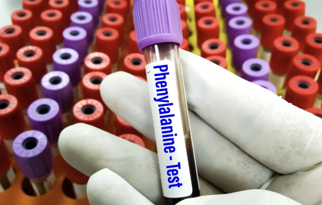 εργαστήριο, Φαινυλκετονουρία, επιστήμονες