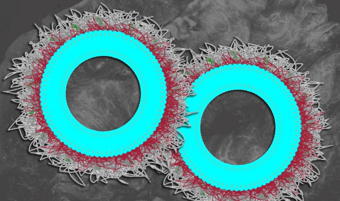 νανοσωματίδια καρκίνος