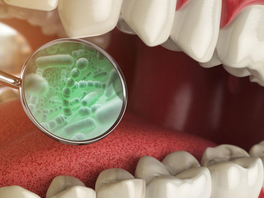 καρκίνος παγκρέατος στοματική υγεία