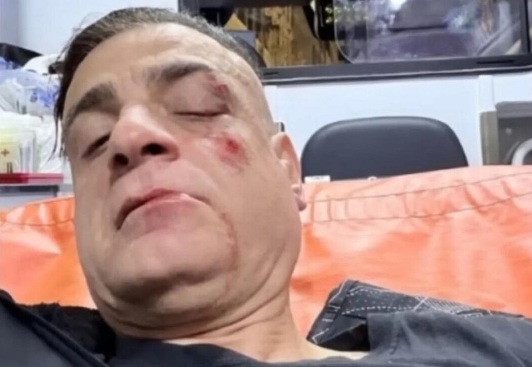 Ρώμη youtuber ξυλοδαρμός