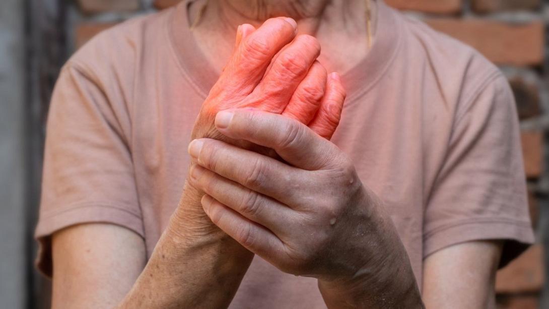 ρευματοειδής αρθρίτιδα