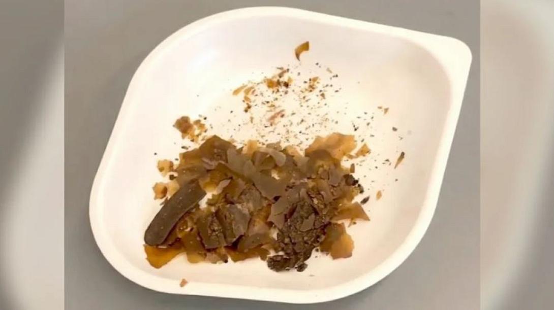 κόπρανα, γιατρικό