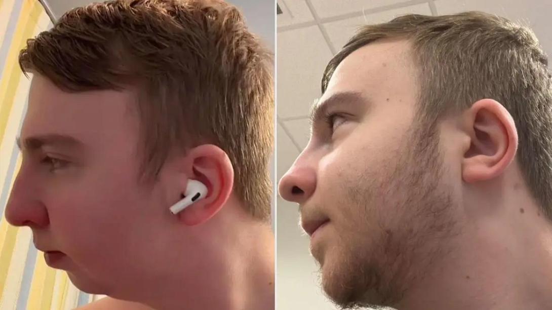 γνάθος, χειρουργειο