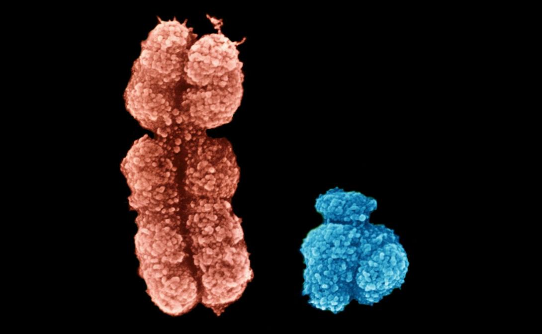 χρωμόσωμα Υ 