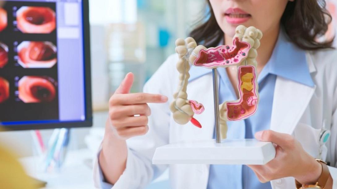 ΚΑΡΚΙΝΟΣ ΠΑΧΕΟΣ ΕΝΤΕΡΟΥ