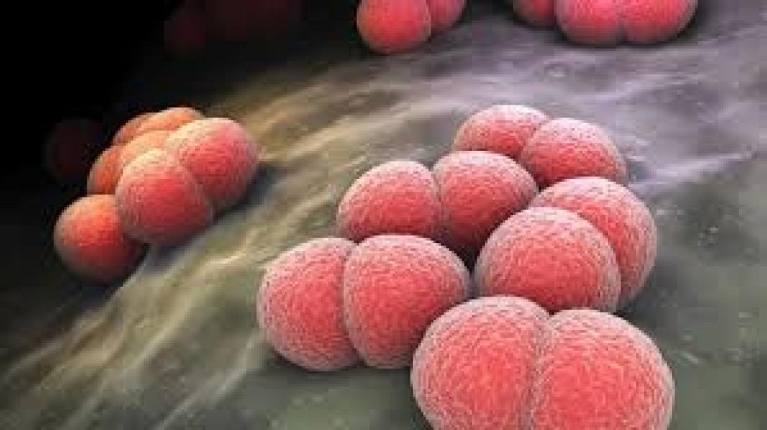 μηνιγγίτιδα