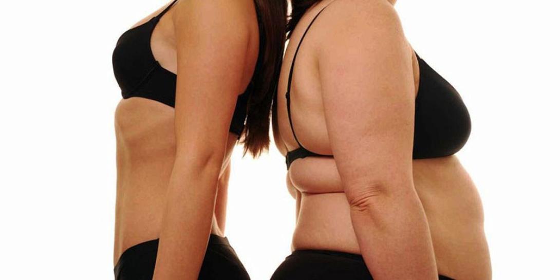 παχυσαρκία