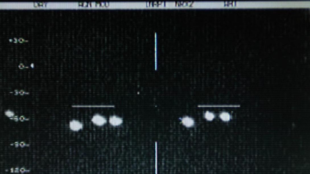 UFO