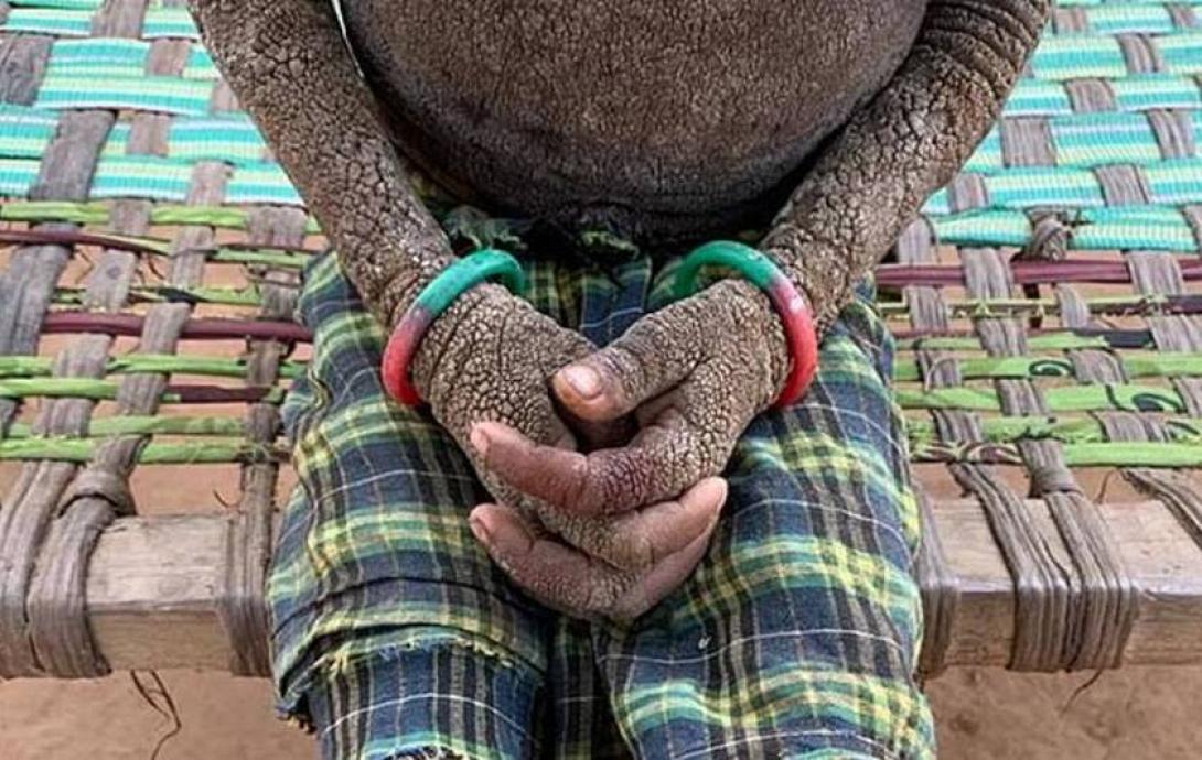 κοριτσάκι στην Ινδία