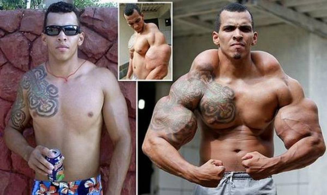 25xronos_ekane_eneseis_alkool_me_lathi_gia_na_ftiaksei_mpratsa_paraksena_perierga_bodybuilder.jpg