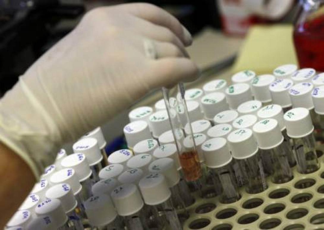 Φιαλίδια με ιό της ευλογιάς ανακαλύφθηκαν σε εργαστήριο της Ουάσινγκτον