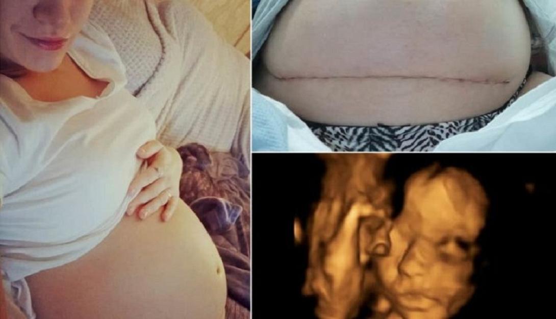 αγεννητο μωρό