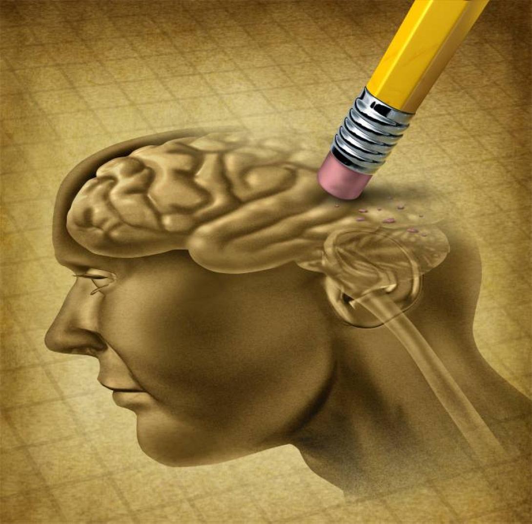 alzheimer