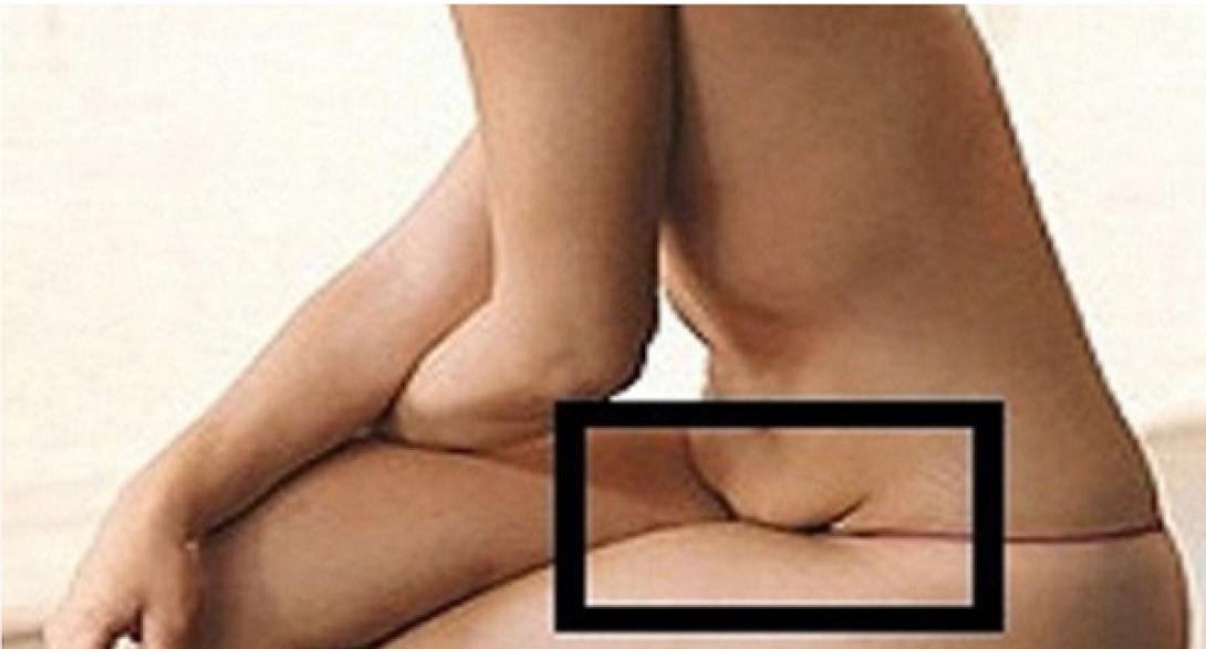 apallageite_apo_ti_pesmeni_koilia_me_ayto_to_poly_apotelesmatiko_fysiko_poto.png