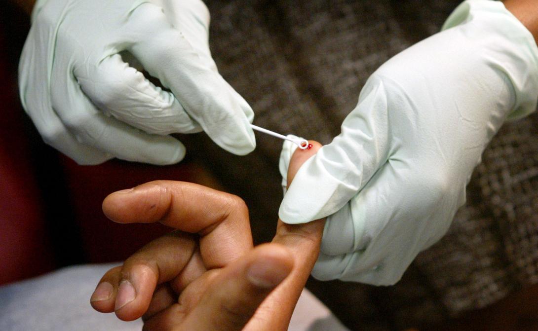 Επανεμφανίστηκε ο ιός HIV και στο δεύτερο παιδί που είχε «θεραπευτεί»