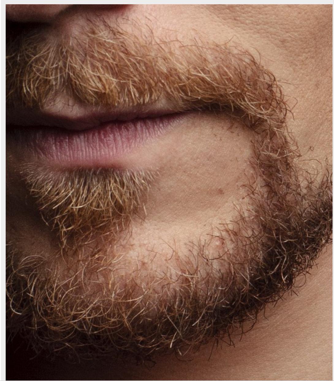 Ομογενής προσέφυγε στο Ανώτατο Δικαστήριο για... τις τρίχες του