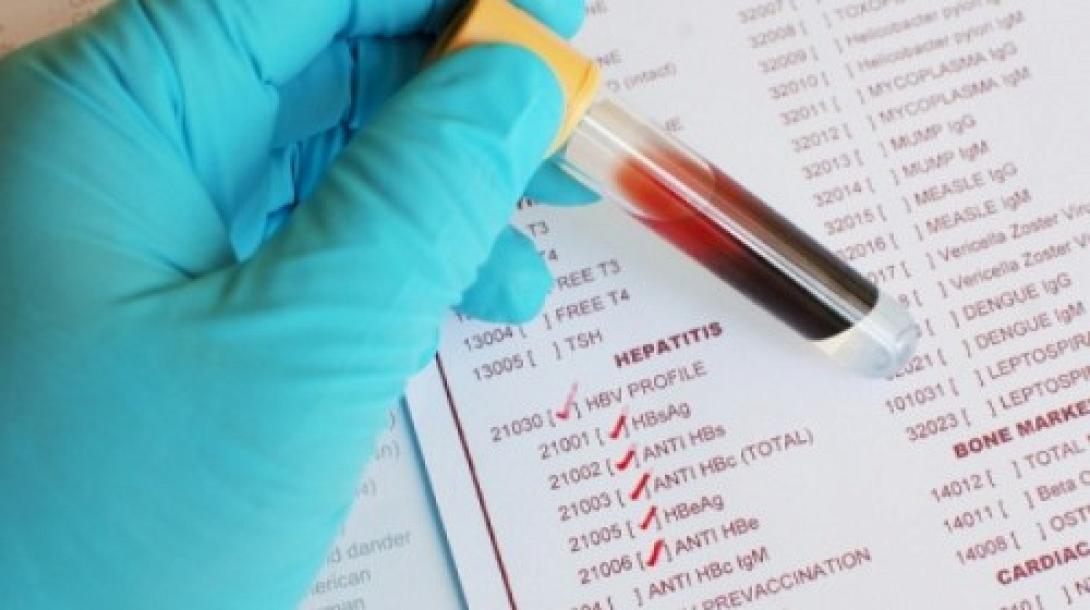 hepatitis