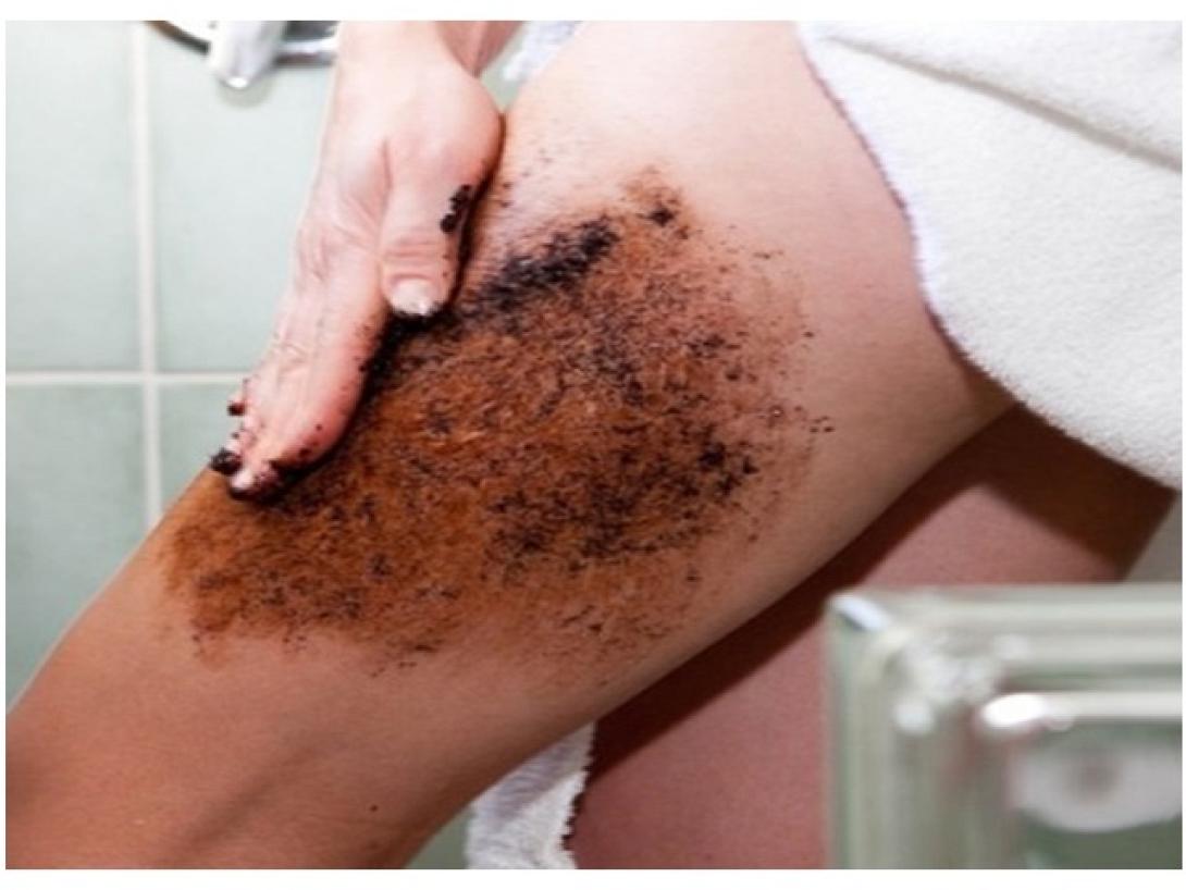 cellulite.jpg