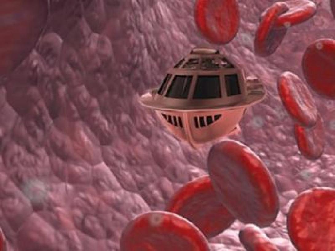 ΑΝΤ (Actuating Nano-Transducer) 