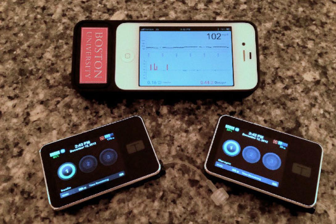 Φορητό βιονικό πάγκρεας για τους ασθενείς με διαβήτη