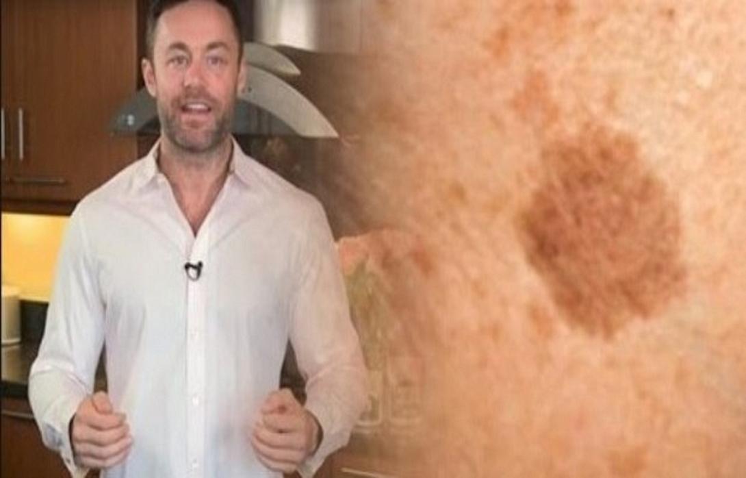diasimos_dermatologos_apokalyptei_apallageite_apo_tis_kafe_kilides_me_ayto_to_aplo_tehnasma.jpg