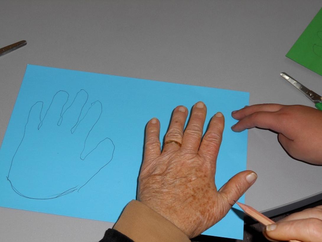 αλτσχάιμερ