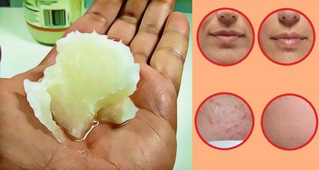 fysiki_therapeia_gia_meiosi_tis_tis_halarosis_kai_ton_rytidon_toy_prosopoy.jpg