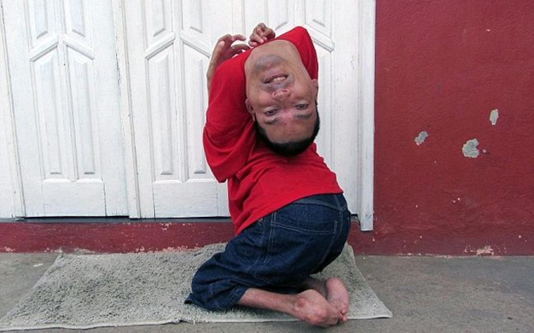 Γεννήθηκε με το κεφάλι ... ανάποδα (φωτογραφίες)