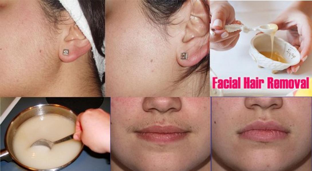 get-rid-of-facial-hair-naturally.jpg