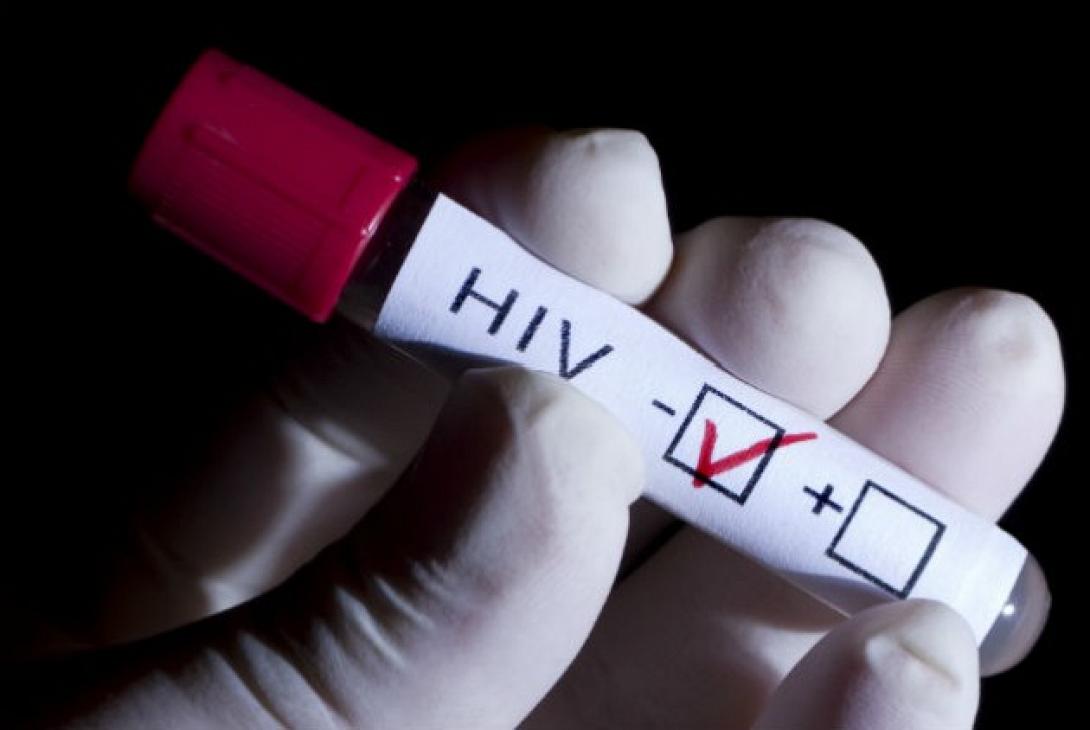 hiv