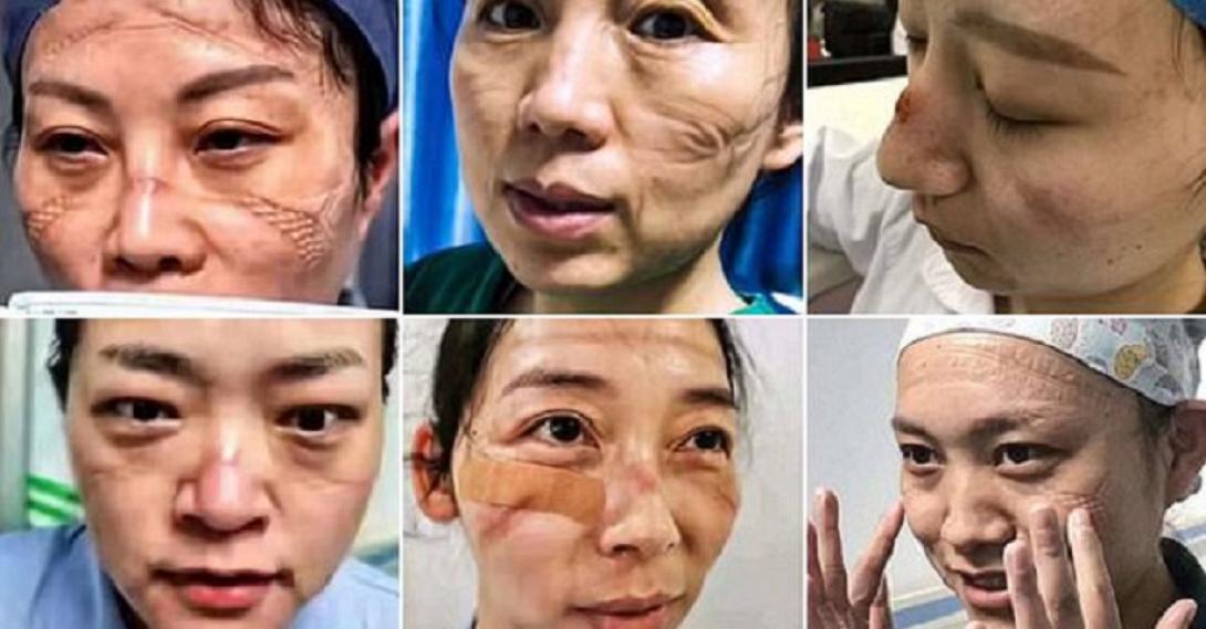 Γουχά-κορωνοϊος-γιατροί